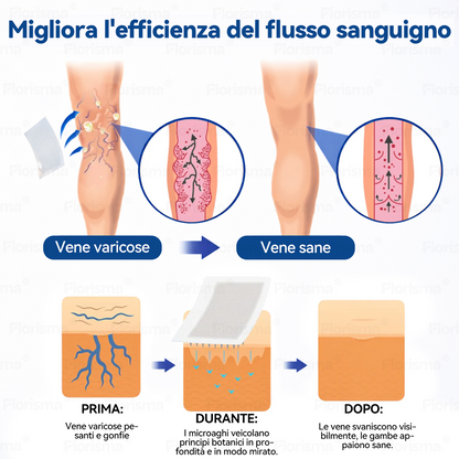 🛡️ 𝑭𝑳𝑶𝑹𝑰𝑺𝑴𝑨® 💕 Cerotto Microneedle di Grado Clinico (con Diosmina ed Esperidina) — Progettato specificamente per contrastare i capillari visibili e le vene varicose, aiutando al contempo ad alleviare la sensazione di gambe pesanti e affaticate. 👩‍⚕️