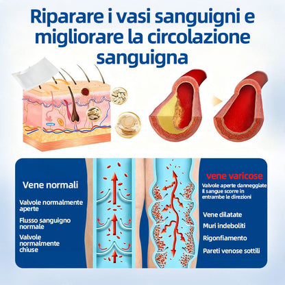 🛡️ 𝐅𝐥𝐨𝐫𝐢𝐬𝐦𝐚® 💕 Cerotto Microneedle di Grado Clinico (con Diosmina ed Esperidina) — Progettato specificamente per contrastare i capillari visibili e le vene varicose, aiutando al contempo ad alleviare la sensazione di gambe pesanti e affaticate. 👩‍⚕️