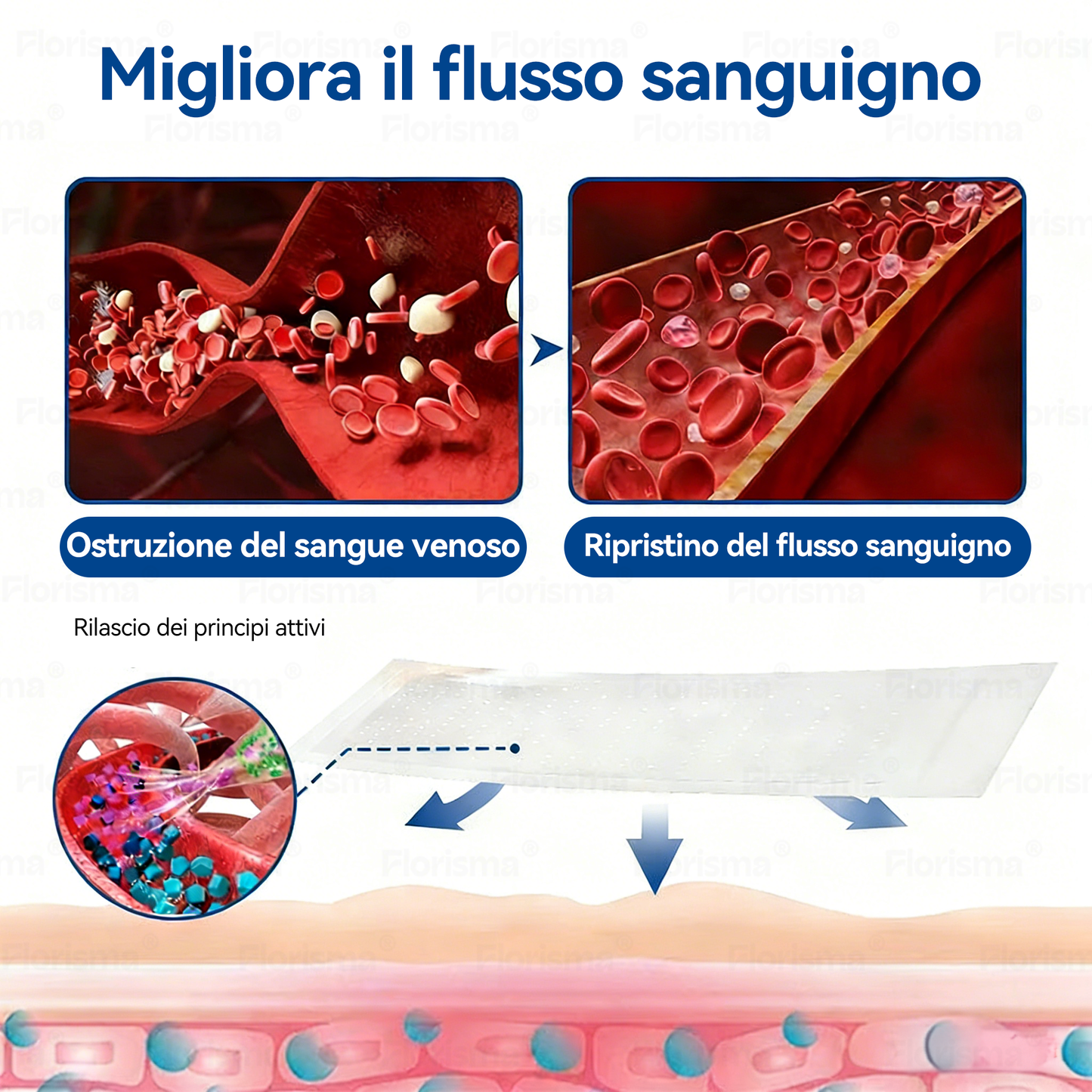 🛡️ 𝑭𝑳𝑶𝑹𝑰𝑺𝑴𝑨® 💕 Cerotto Microneedle di Grado Clinico (con Diosmina ed Esperidina) — Progettato specificamente per contrastare i capillari visibili e le vene varicose, aiutando al contempo ad alleviare la sensazione di gambe pesanti e affaticate. 👩‍⚕️