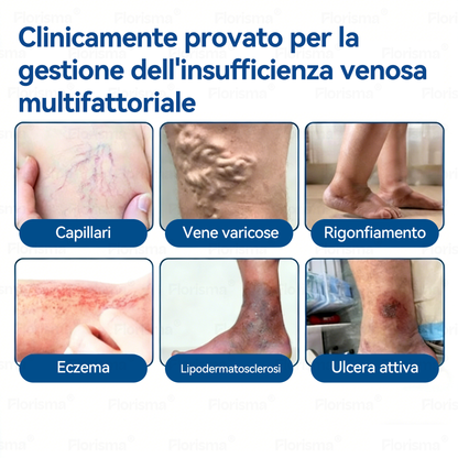 🛡️ 𝑭𝑳𝑶𝑹𝑰𝑺𝑴𝑨® 💕 Cerotto Microneedle di Grado Clinico (con Diosmina ed Esperidina) — Progettato specificamente per contrastare i capillari visibili e le vene varicose, aiutando al contempo ad alleviare la sensazione di gambe pesanti e affaticate. 👩‍⚕️