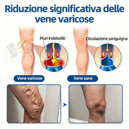 🛡️ 𝐅𝐥𝐨𝐫𝐢𝐬𝐦𝐚® 💕 Cerotto Microneedle di Grado Clinico (con Diosmina ed Esperidina) — Progettato specificamente per contrastare i capillari visibili e le vene varicose, aiutando al contempo ad alleviare la sensazione di gambe pesanti e affaticate. 👩‍⚕️